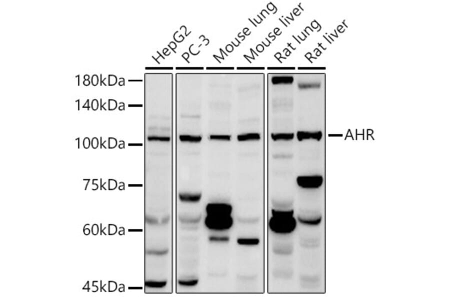 Western Blot - Anti-Aryl hydrocarbon Receptor Antibody (A13457) - Antibodies.com