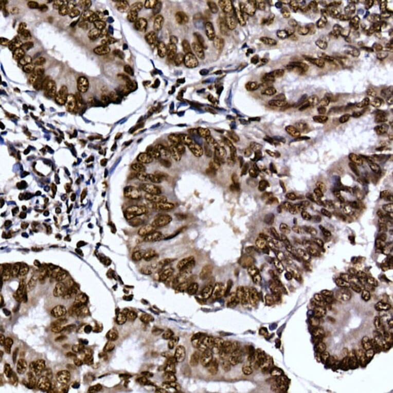 Immunohistochemistry - Anti-Aryl hydrocarbon Receptor Antibody (A13457) - Antibodies.com