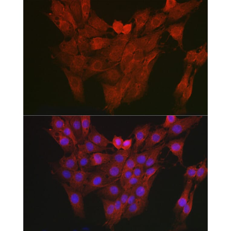 Immunofluorescence - Anti-Aryl hydrocarbon Receptor Antibody (A13457) - Antibodies.com