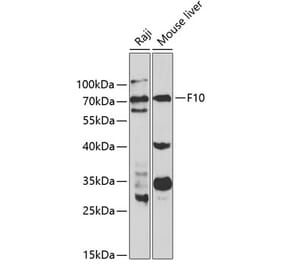 Western Blot - Anti-Factor X Antibody (A13458) - Antibodies.com