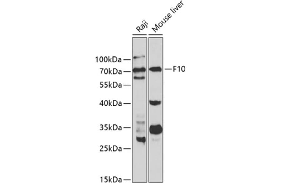 Western Blot - Anti-Factor X Antibody (A13458) - Antibodies.com