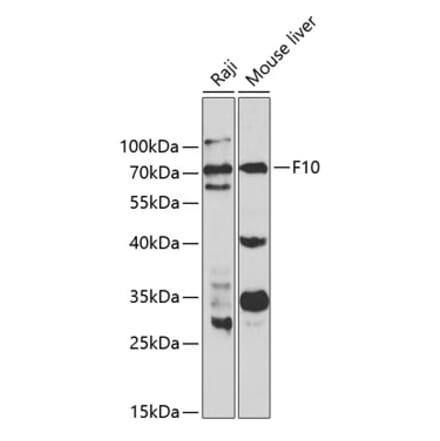 Western Blot - Anti-Factor X Antibody (A13458) - Antibodies.com