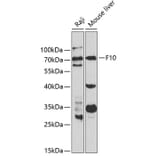 Western Blot - Anti-Factor X Antibody (A13458) - Antibodies.com