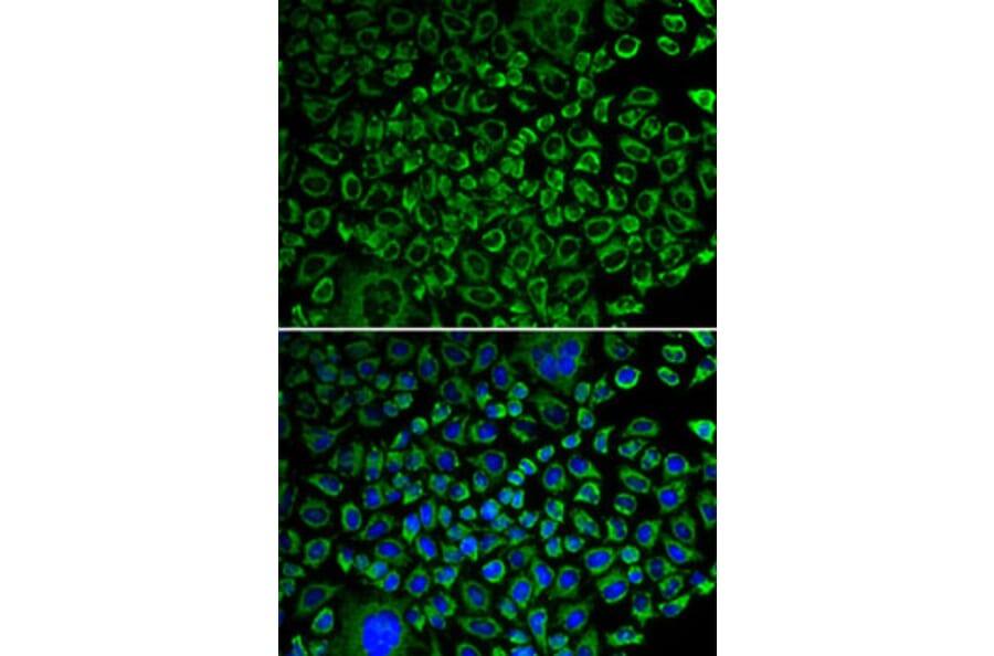Immunofluorescence - Anti-Factor X Antibody (A13458) - Antibodies.com