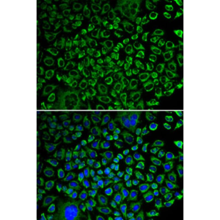 Immunofluorescence - Anti-Factor X Antibody (A13458) - Antibodies.com