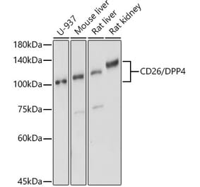 Western Blot - Anti-DPP4 Antibody (A13459) - Antibodies.com
