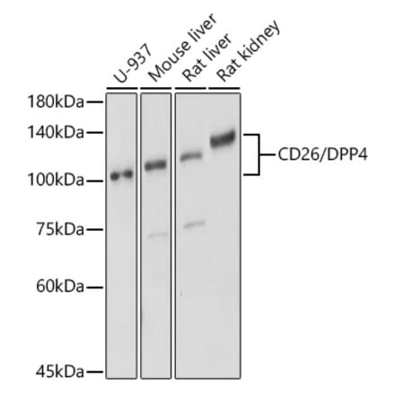 Western Blot - Anti-DPP4 Antibody (A13459) - Antibodies.com