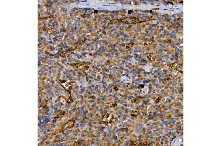 Immunohistochemistry - Anti-DPP4 Antibody (A13459) - Antibodies.com