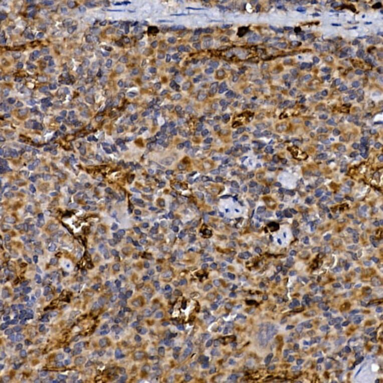 Immunohistochemistry - Anti-DPP4 Antibody (A13459) - Antibodies.com