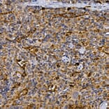 Immunohistochemistry - Anti-DPP4 Antibody (A13459) - Antibodies.com