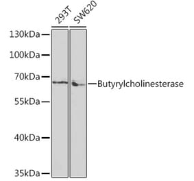 Western Blot - Anti-Butyrylcholinesterase Antibody (A13460) - Antibodies.com
