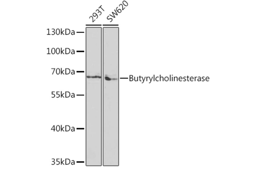 Western Blot - Anti-Butyrylcholinesterase Antibody (A13460) - Antibodies.com