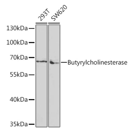 Western Blot - Anti-Butyrylcholinesterase Antibody (A13460) - Antibodies.com