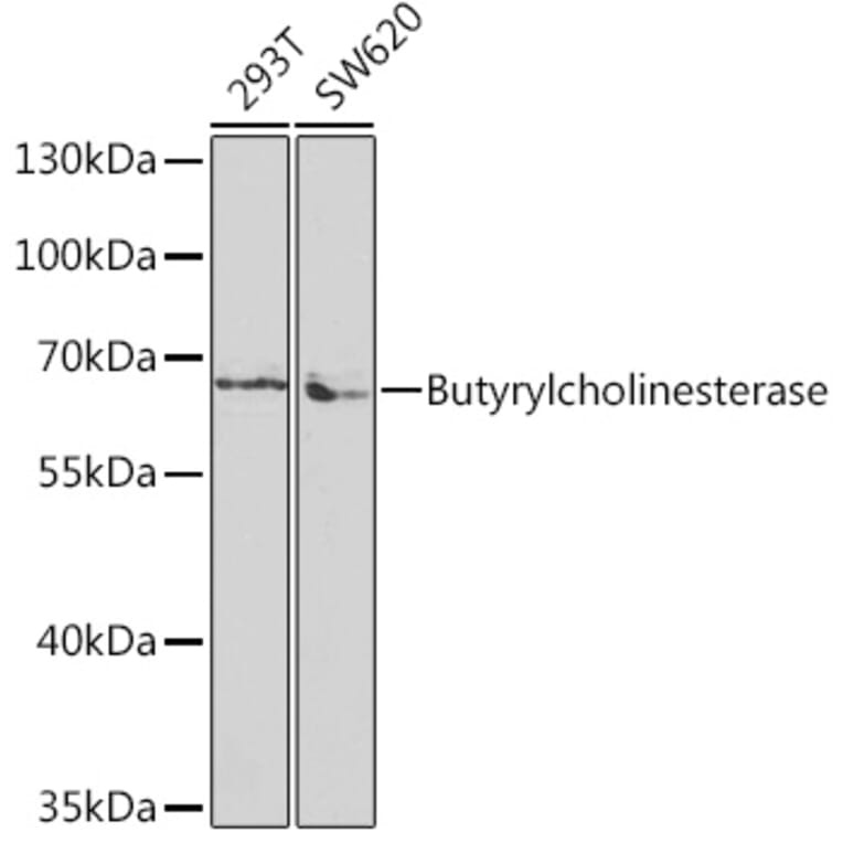 Western Blot - Anti-Butyrylcholinesterase Antibody (A13460) - Antibodies.com
