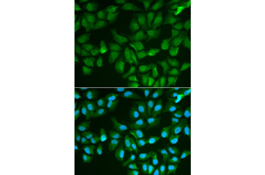 Immunofluorescence - Anti-Galectin 3 Antibody (A13461) - Antibodies.com