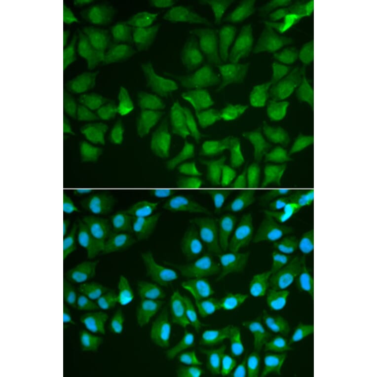 Immunofluorescence - Anti-Galectin 3 Antibody (A13461) - Antibodies.com