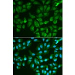 Immunofluorescence - Anti-Galectin 3 Antibody (A13461) - Antibodies.com