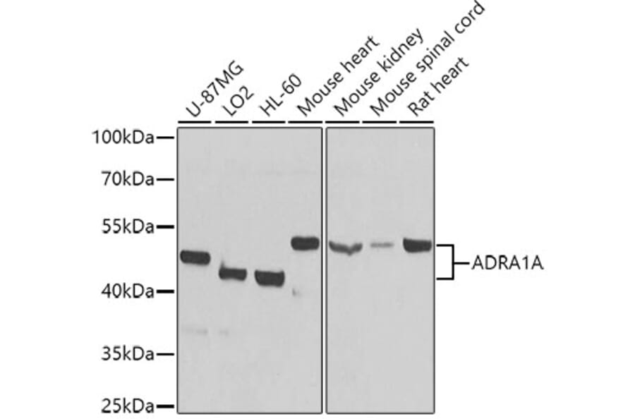 Western Blot - Anti-alpha 1a Adrenergic Receptor/ADRA1A Antibody (A13462) - Antibodies.com