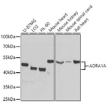 Western Blot - Anti-alpha 1a Adrenergic Receptor/ADRA1A Antibody (A13462) - Antibodies.com