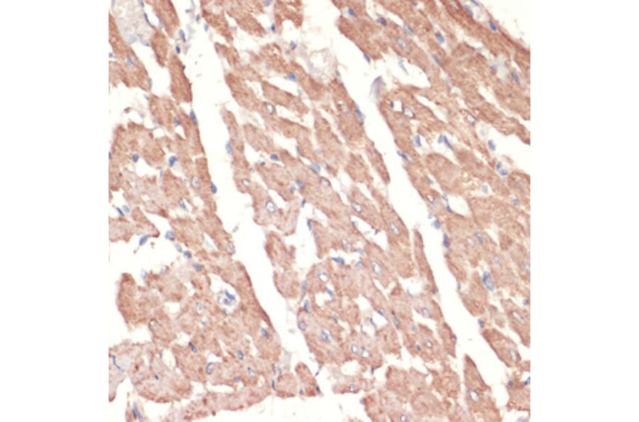 Immunohistochemistry - Anti-alpha 1a Adrenergic Receptor/ADRA1A Antibody (A13462) - Antibodies.com