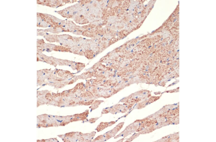 Immunohistochemistry - Anti-alpha 1a Adrenergic Receptor/ADRA1A Antibody (A13462) - Antibodies.com