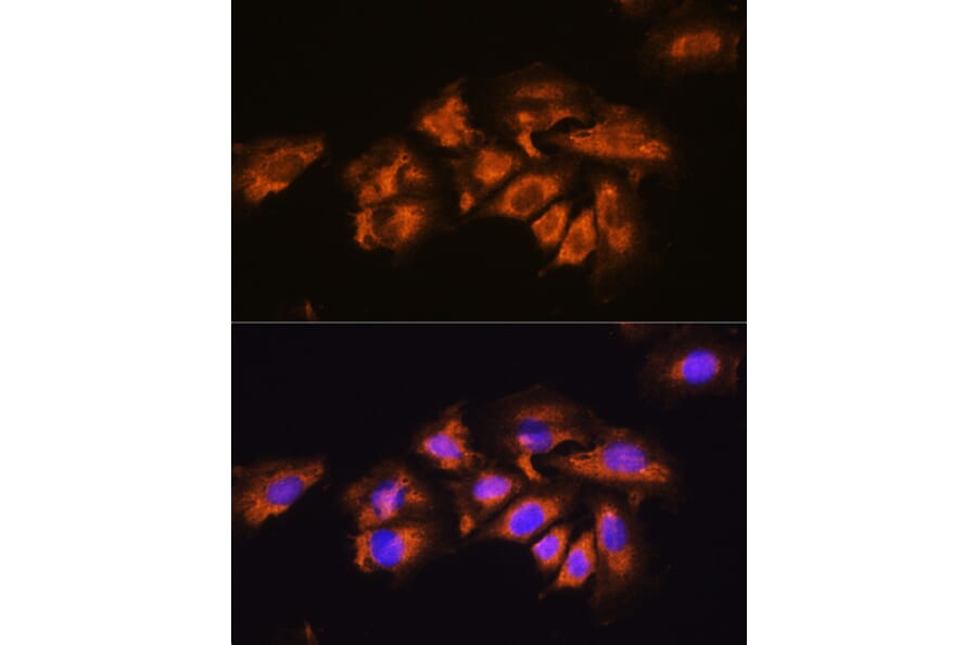 Immunofluorescence - Anti-alpha 1a Adrenergic Receptor/ADRA1A Antibody (A13462) - Antibodies.com