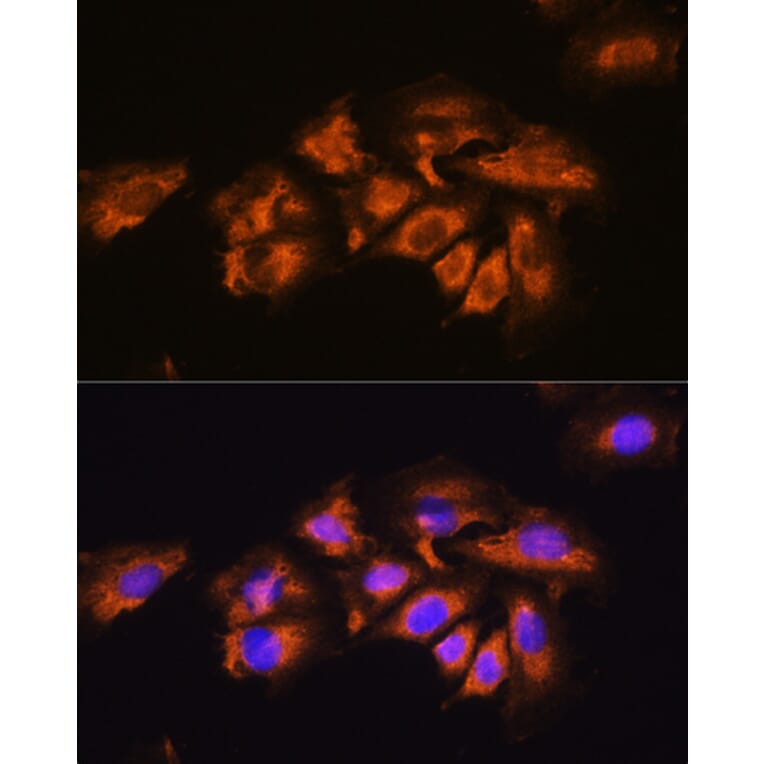 Immunofluorescence - Anti-alpha 1a Adrenergic Receptor/ADRA1A Antibody (A13462) - Antibodies.com