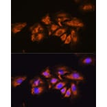 Immunofluorescence - Anti-alpha 1a Adrenergic Receptor/ADRA1A Antibody (A13462) - Antibodies.com