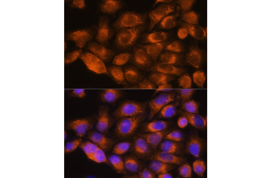Immunofluorescence - Anti-alpha 1a Adrenergic Receptor/ADRA1A Antibody (A13462) - Antibodies.com