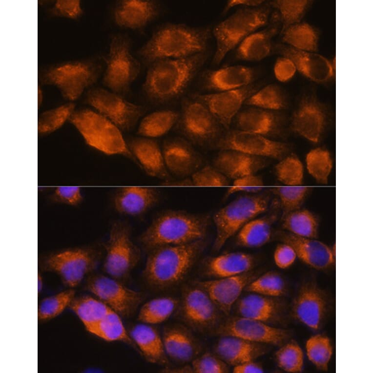 Immunofluorescence - Anti-alpha 1a Adrenergic Receptor/ADRA1A Antibody (A13462) - Antibodies.com