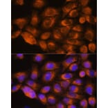 Immunofluorescence - Anti-alpha 1a Adrenergic Receptor/ADRA1A Antibody (A13462) - Antibodies.com
