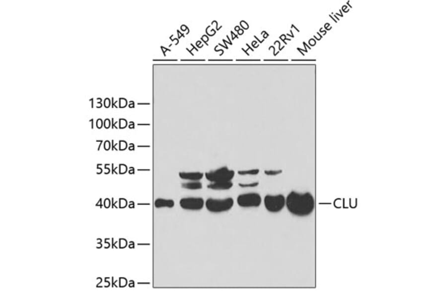 Western Blot - Anti-CLU Antibody (A1472) - Antibodies.com