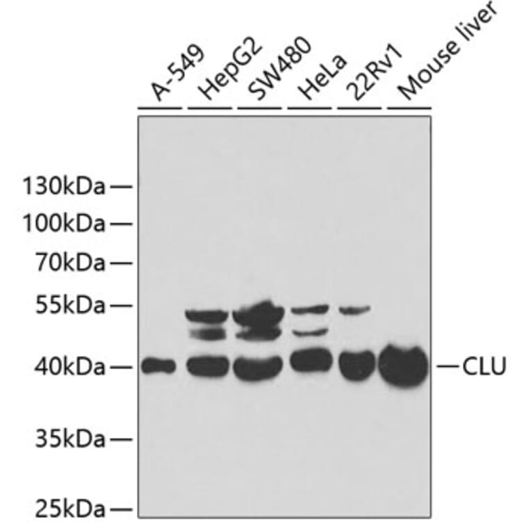 Western Blot - Anti-CLU Antibody (A1472) - Antibodies.com