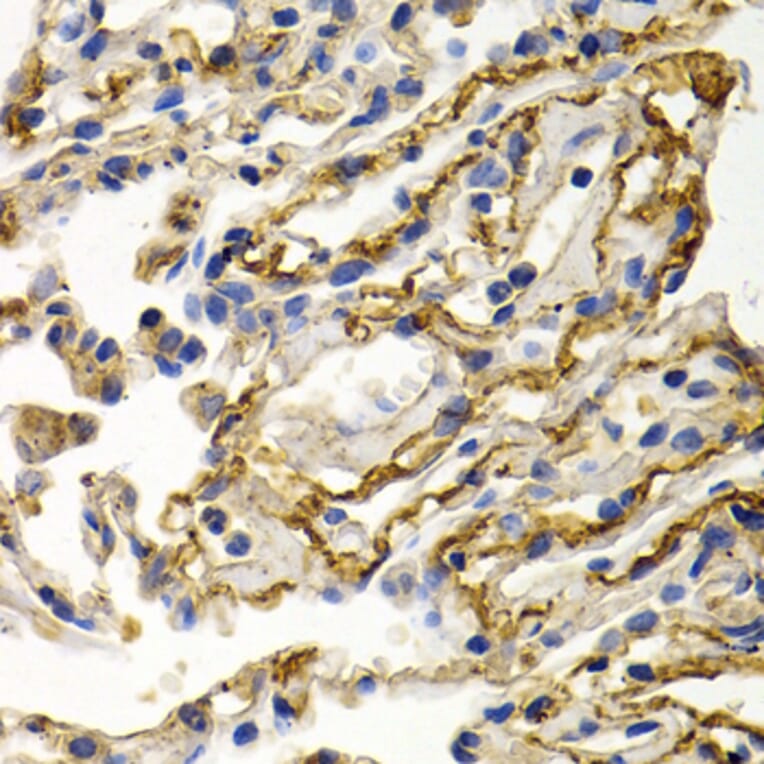 Immunohistochemistry - Anti-CLU Antibody (A1472) - Antibodies.com