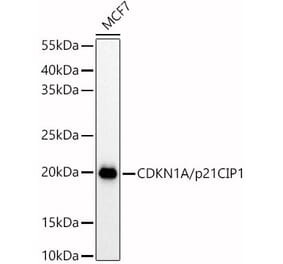 Western Blot - Anti-p21 Antibody (A13465) - Antibodies.com