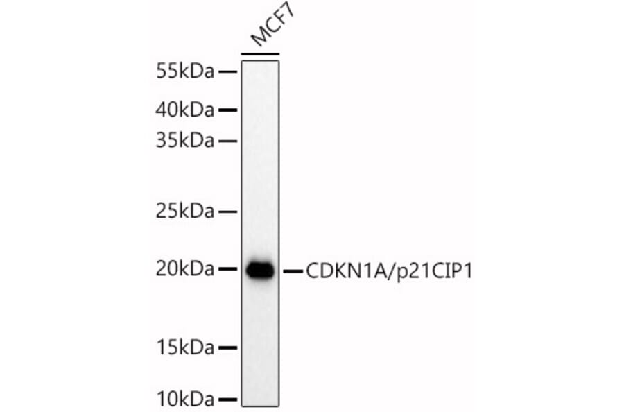 Western Blot - Anti-p21 Antibody (A13465) - Antibodies.com