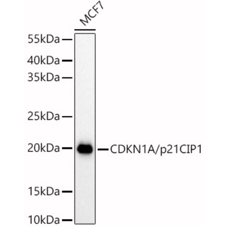 Western Blot - Anti-p21 Antibody (A13465) - Antibodies.com