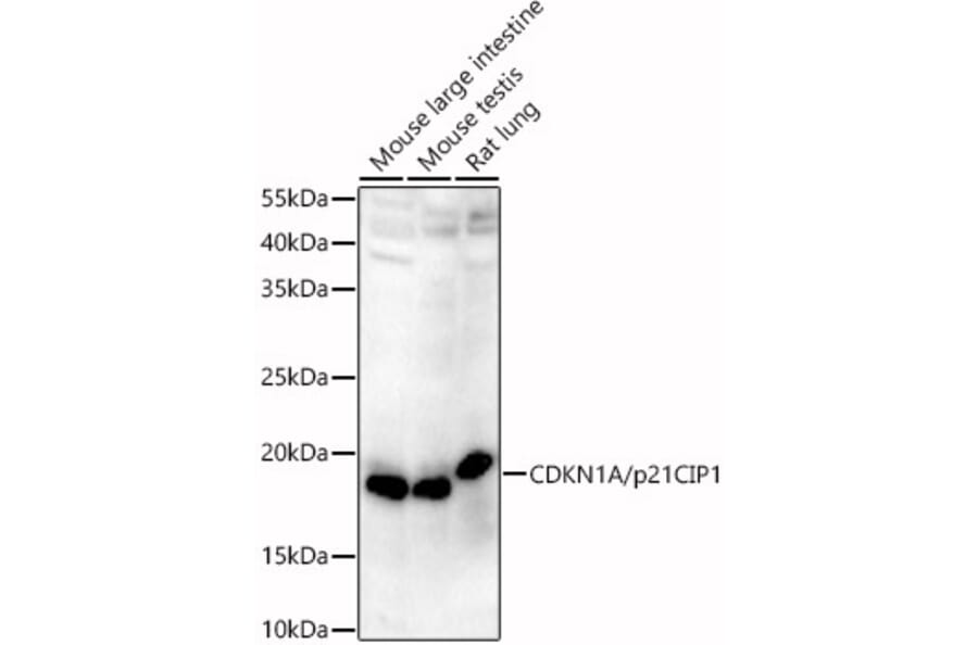 Western Blot - Anti-p21 Antibody (A13465) - Antibodies.com