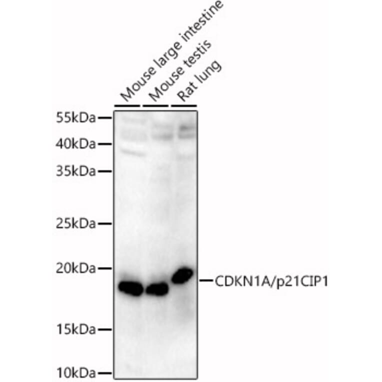 Western Blot - Anti-p21 Antibody (A13465) - Antibodies.com