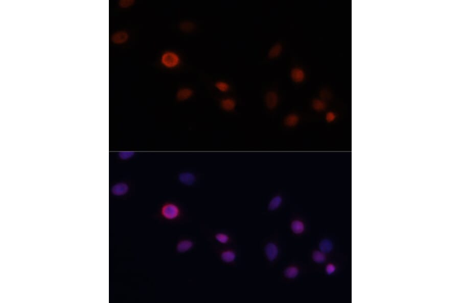 Immunofluorescence - Anti-p21 Antibody (A13465) - Antibodies.com