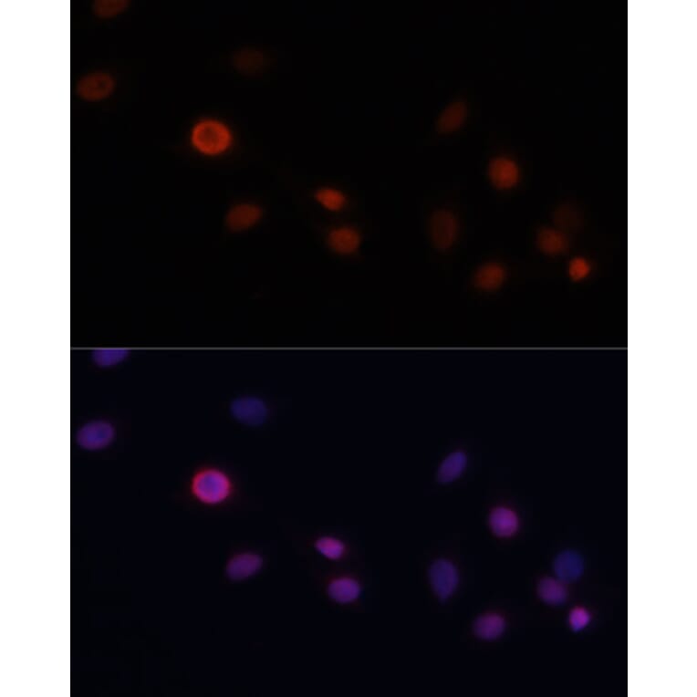 Immunofluorescence - Anti-p21 Antibody (A13465) - Antibodies.com
