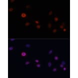 Immunofluorescence - Anti-p21 Antibody (A13465) - Antibodies.com