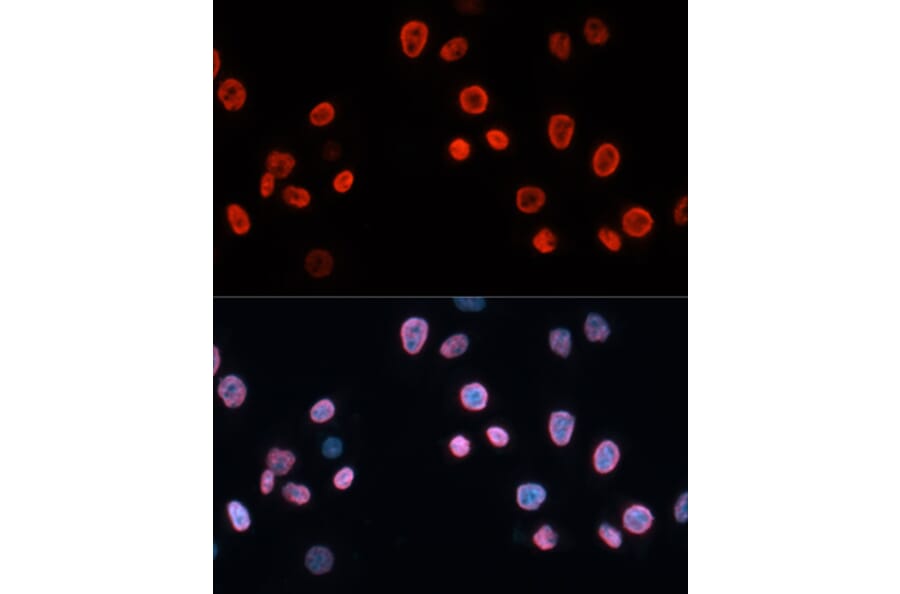 Immunofluorescence - Anti-p21 Antibody (A13465) - Antibodies.com