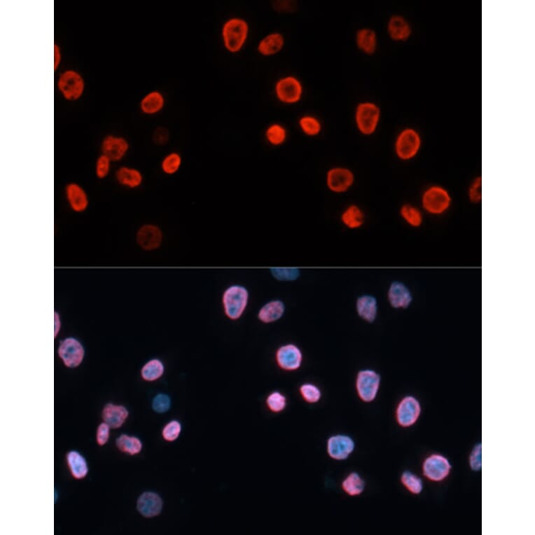 Immunofluorescence - Anti-p21 Antibody (A13465) - Antibodies.com
