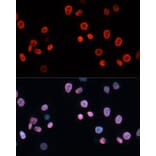 Immunofluorescence - Anti-p21 Antibody (A13465) - Antibodies.com