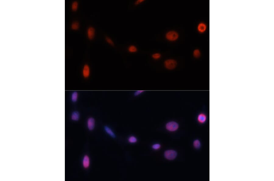 Immunofluorescence - Anti-p21 Antibody (A13465) - Antibodies.com