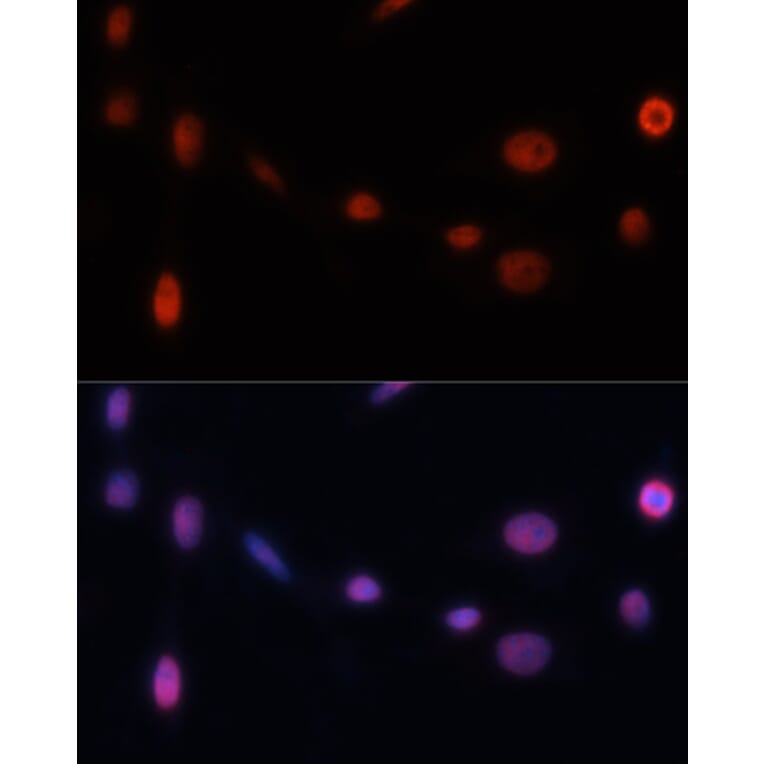 Immunofluorescence - Anti-p21 Antibody (A13465) - Antibodies.com