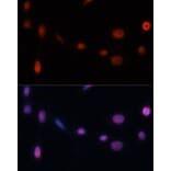 Immunofluorescence - Anti-p21 Antibody (A13465) - Antibodies.com