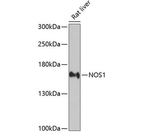 Western Blot - Anti-nNOS (neuronal) Antibody (A13467) - Antibodies.com
