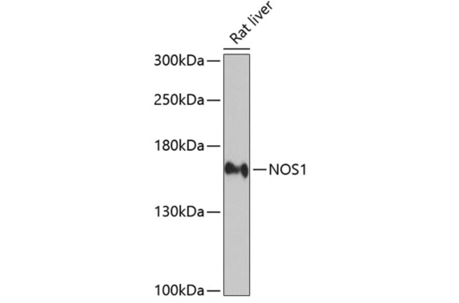 Western Blot - Anti-nNOS (neuronal) Antibody (A13467) - Antibodies.com